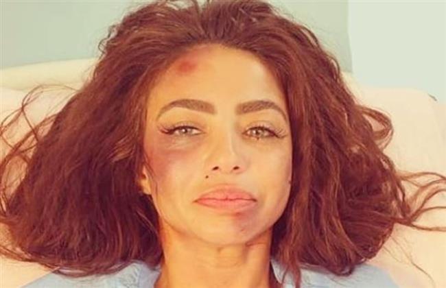 دوللي شاهين تخدع جمهورها بقصة تعرضها للتعنيف