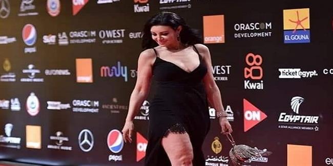 أروى جودة: «أنا مش فارق معايا إن يكون عندي سيلوليت»