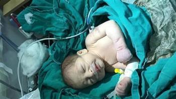 نهشته الكلاب.. العثور علي جثة طفل رضيع ملقي بالقمامة في المعادي