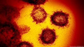   خبراء بريطانيون: حالات العدوى المقاومة للمضادات الحيوية تهدد بحدوث أوبئة جديدة