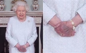    يد الملكة إليزابيث تكشف عن مرضها