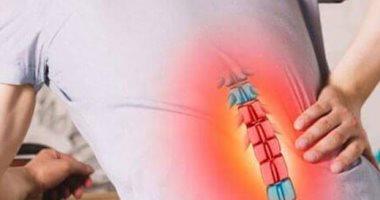  بدون جراحة.. علاجات منزلية لعلاج الانزلاق الغضروفي