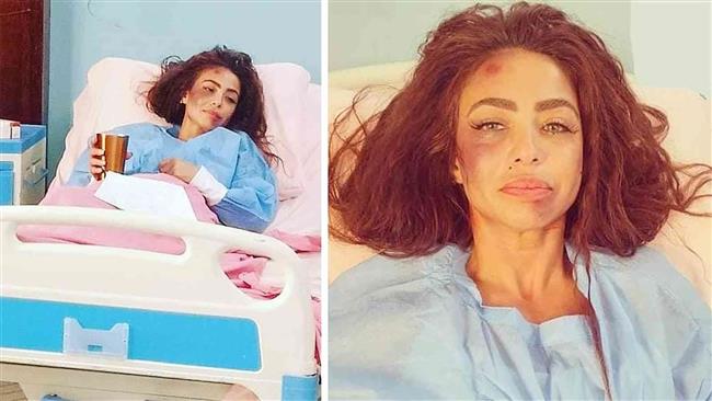 تفاصيل تعدى 3 سيدات على الفنانة دوللى شاهين