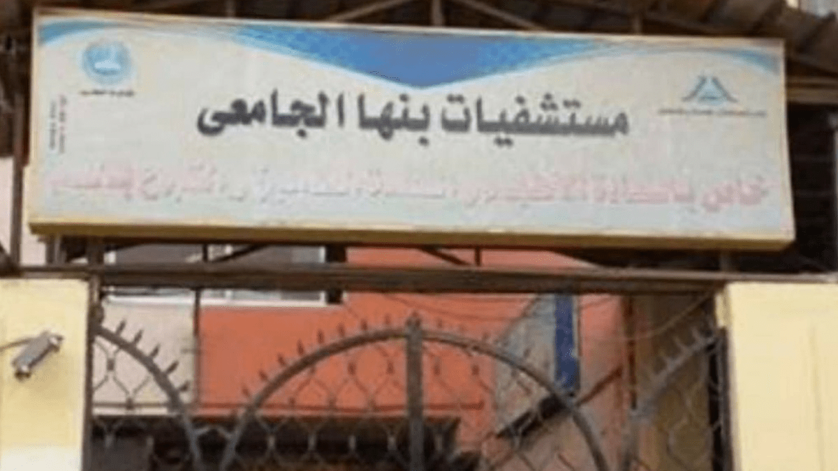 استئصال حصوة «كبيرة» من أسفل فك مريض ببنها الجامعي