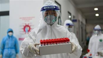   «الصحة العالمية»: نراقب متحور بيرو لفيروس كورونا لتحديد سرعة انتشاره
