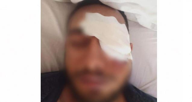 انفجار قرنية عين طالب ضربه سائق بحجر بـ15 مايو