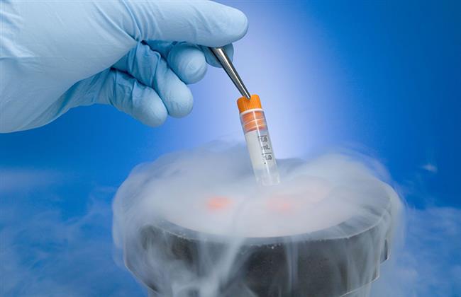  استشارى حقن مجهرى: تجميد البويضات الطريق الأمثل للإنجاب في المستقبل
