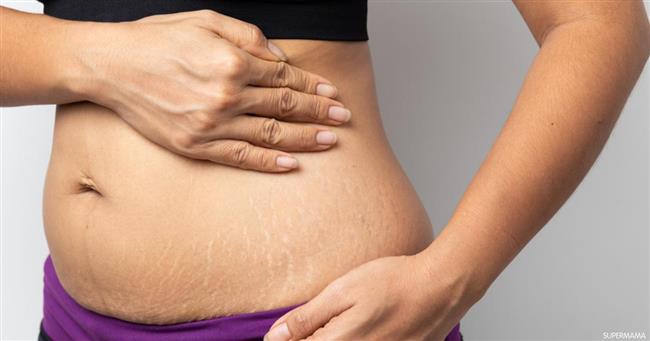 استشارى تجميل: عمليات التجميل تزيل أثار الحمل والولادة والدهون الزائدة 