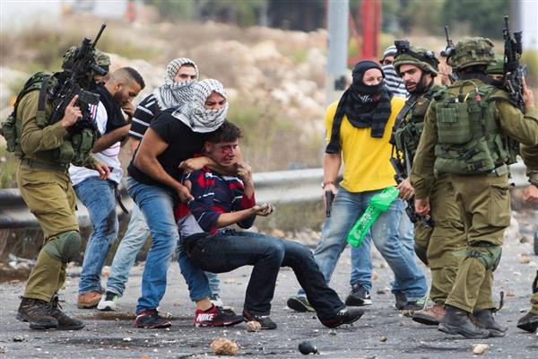 174 إصابة خلال مواجهات مع الاحتلال الإسرائيلي في نابلس