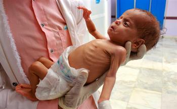   الأمم المتحدة: 16 مليون يمنى يسيرون نحو المجاعة