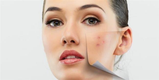 8 أطعمة تدمر البشرة تجنبيها