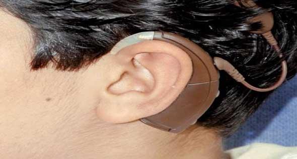 منسق مبادرة ضعف السمع: فحصنا أكثر من 2 مليون طفل