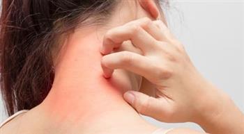 5 إشارات تنذر بإصابتك بالسرطان