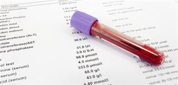 تحليل دم يكشف عن مرض السرطان "قبل انتشاره"