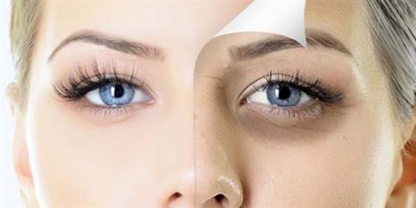 4 وصفات لعلاج العيون المرهقة