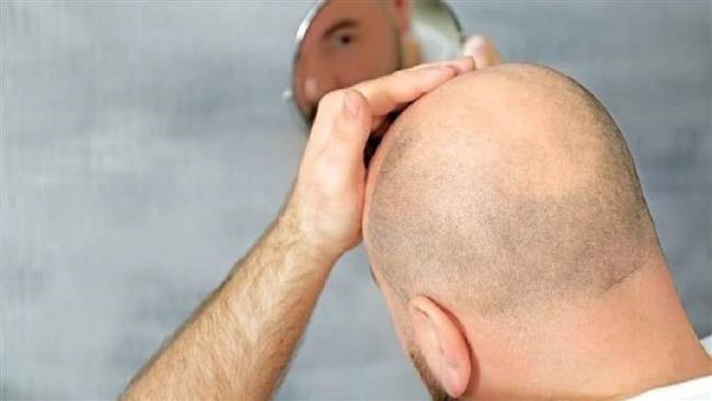 في موزمبيق.. قطع رأس رجل أصلع للاعتقاد أن بداخلها ذهبًا