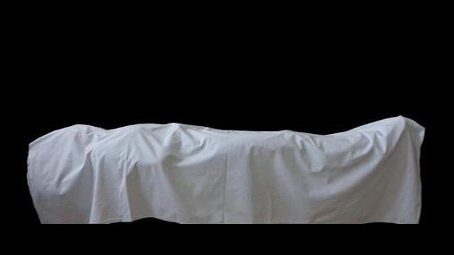 ما حكم دفن العضو المبتور من الإنسان؟