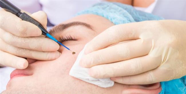 الإفتاء: عمليات التجميل تجوز وليست من تغيير خلق الله