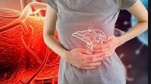علامة شائعة على الوجه مؤشر لإصابتك بتليف الكبد