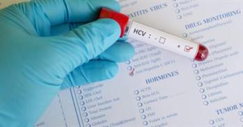   الصحة: حملة الرئيس للقضاء على فيروس سى عالجت 4 ملايين مواطن