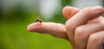   ٤ علاجات منزلية لتخفيف آلام لسعات النحل.. تعرف عليه