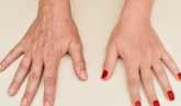  3 وصفات طبيعية للتخلص من التجاعيد وعلامات الشيخوخة على اليدين