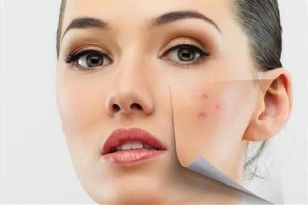 دراسة حديثة تكشف كريمات ومستحضرات تجميل تتسبب في طفح جلدي ..تعرف عليها