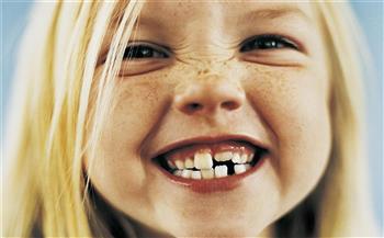   صرير الاسنان عند الاطفال.. الاعراض والأسباب والعلاج