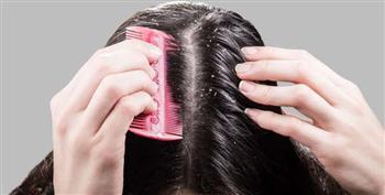 كيفية التخلص من قشرة الشعر