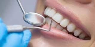   ما حكم بيع الأسنان المخلوعة للأطباء؟.. الإفتاء توضح