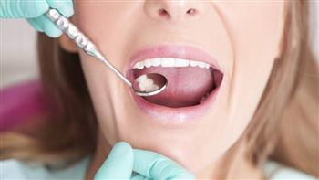   علامات في الفم قد تشير إلى وجود 4 حالات صحية خطيرة