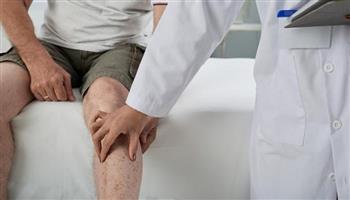 علاقة آلام الساق المتكررة أثناء المشي بتصلب الشرايين 