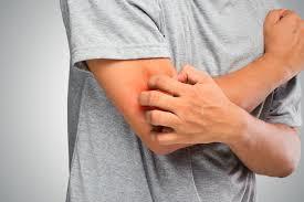 هل التنميل في الجسد من علامات السحر؟ 