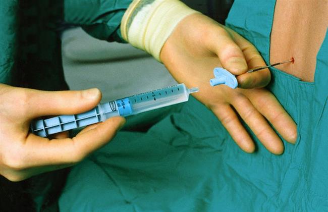 شائعات حول تعرض المرضى للشلل ومضاعفات أخرى..  العلم يثبت براءة «التخدير النصفي»