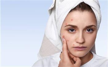 أسباب ظهور الحبوب المؤلمة في الوجه