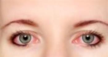دراسة: الإجهاد المتزايد قد يؤدي إلى شيخوخة العين المبكرة
