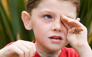   8 اسباب وراء تورم العين عند الاطفال