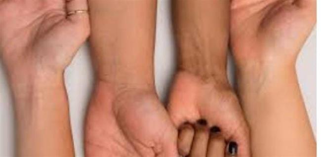 أسباب تغير لون الجلد