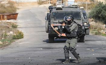الاحتلال يصيب طفل فلسطيني بالرصاص الحي