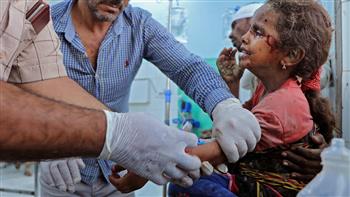   اليمن: إصابة 3 أطفال بقصف حوثى بمأرب