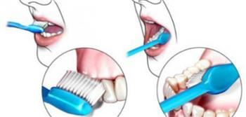   فوائد تنظيف الأسنان
