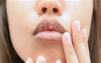   أبرز وأهم المعلومات عن جفاف الفم