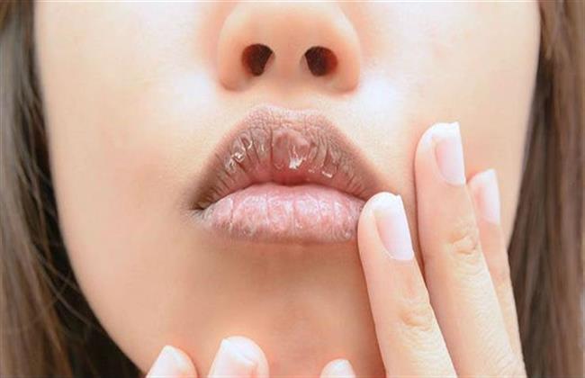 أبرز وأهم المعلومات عن جفاف الفم