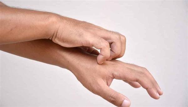 علاجات منزلية سهلة وفعالة لحكة الجلد