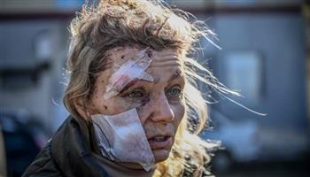   مقتل وإصابة 133 شخصا جراء قصف فى «خاركيف» الأوكرانية