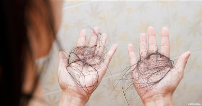  10طرق علاج تساقط الشعر