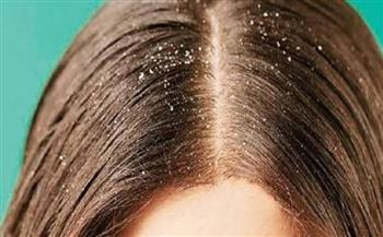  وصفات طبيعية للتخلص من قشرة الشعر