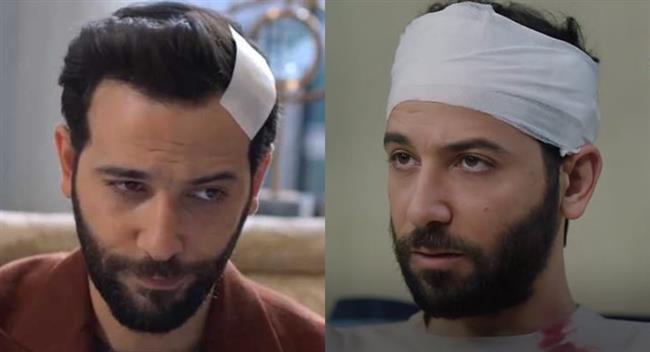 أخطاء في مسلسل "يو تيرن" تغيير مكان جرح كريم قاسم
