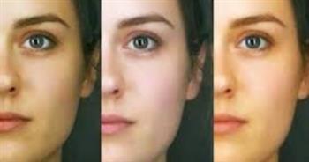 أسباب اسوداد الوجه