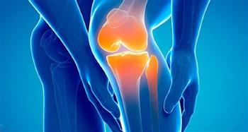   تقوس في الساقين.. أعراض خشونة الركبة المتقدمة